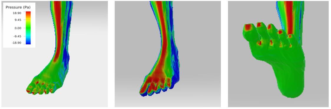 Fig. 2: Surface pressure depending on pedal (orientation) angle; red colour indicates high surface pressure especially around the toe and the dorsum region of the foot