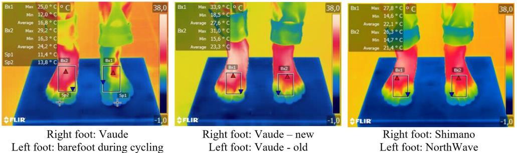 Fig. 5: Figure 6. Thermal images of skin surface temperature (dorsal view; same subject); red colour illustrates warmer temperature, blue colder surface temperature